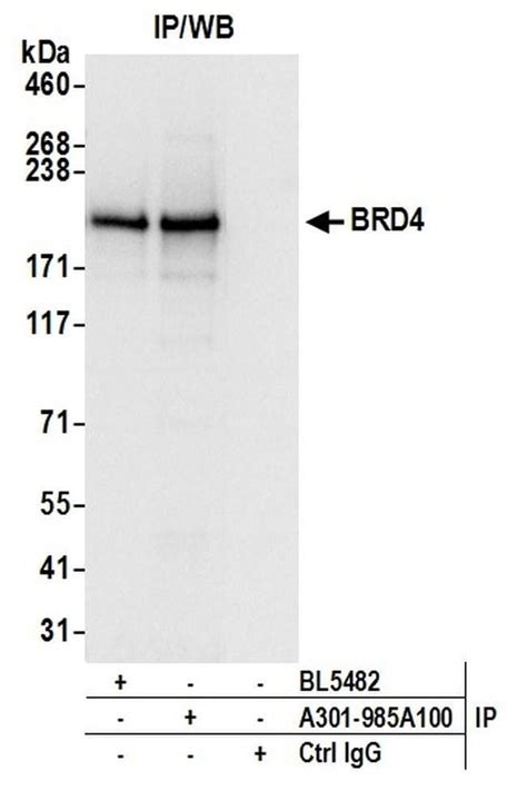 brd4 antibody bethyl|BRD4 Polyclonal Antibody, Bethyl Laboratories .